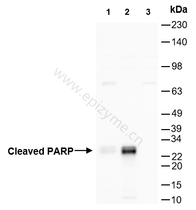 Anti-Cleaved-PARP1 Rabbit mAb [72B40L26]