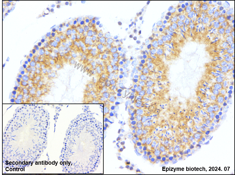 Anti-Bcl-XL Rabbit mAb [71A46G77]