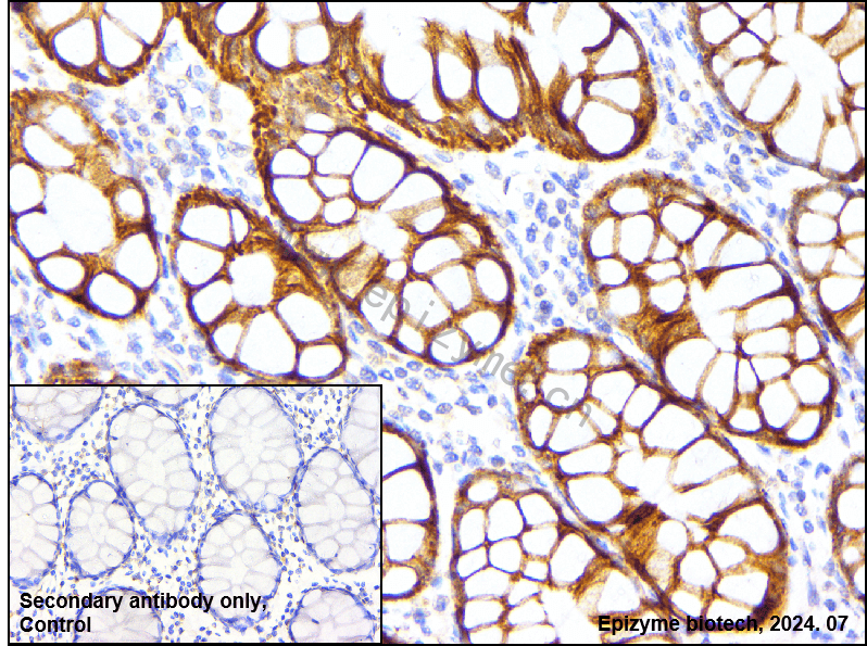 Anti-Bcl-XL Rabbit mAb [71A46G77]