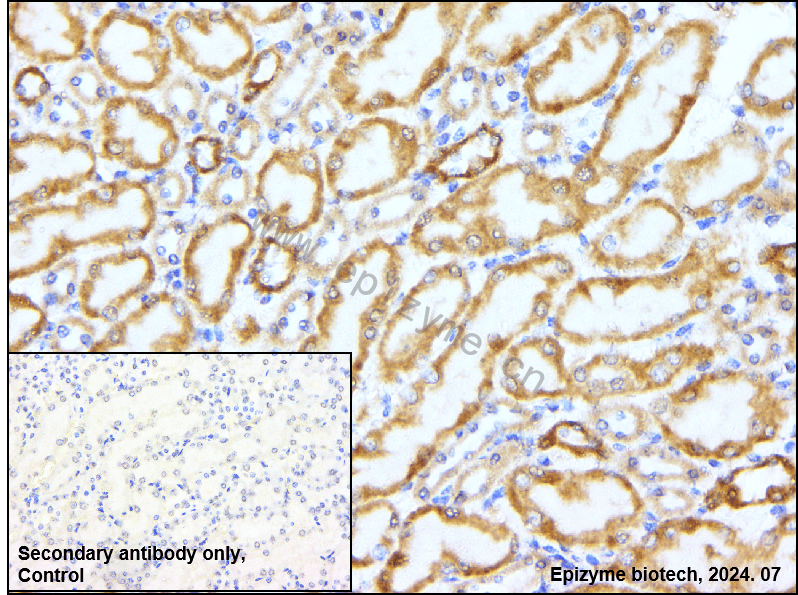Anti-Bcl-XL Rabbit mAb [71A46G77]