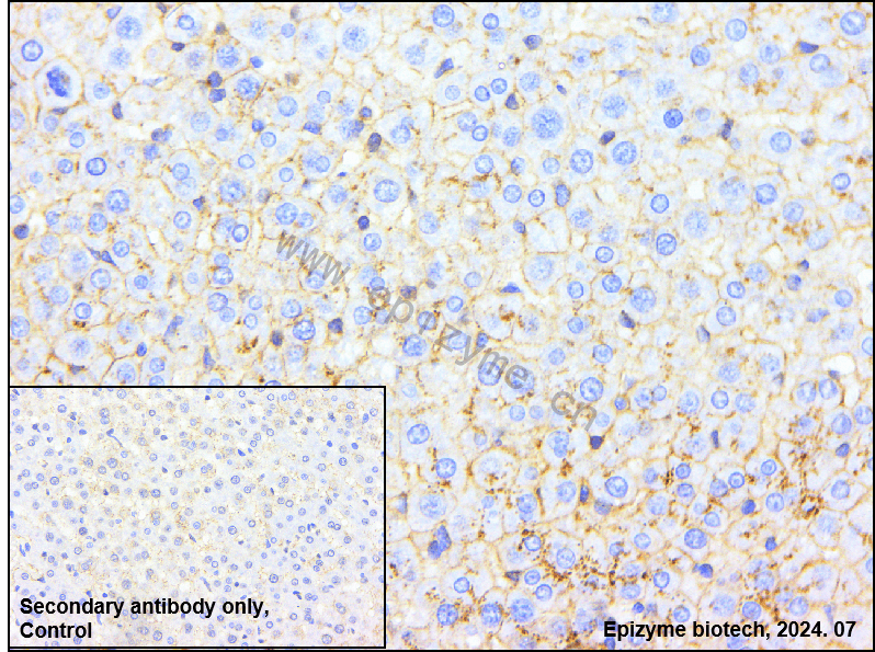 Anti-Flotillin 1 Rabbit mAb [39M15E57]
