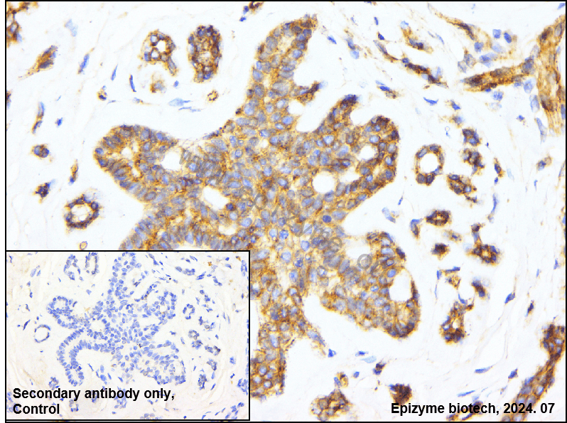 Anti-Flotillin 1 Rabbit mAb [39M15E57]