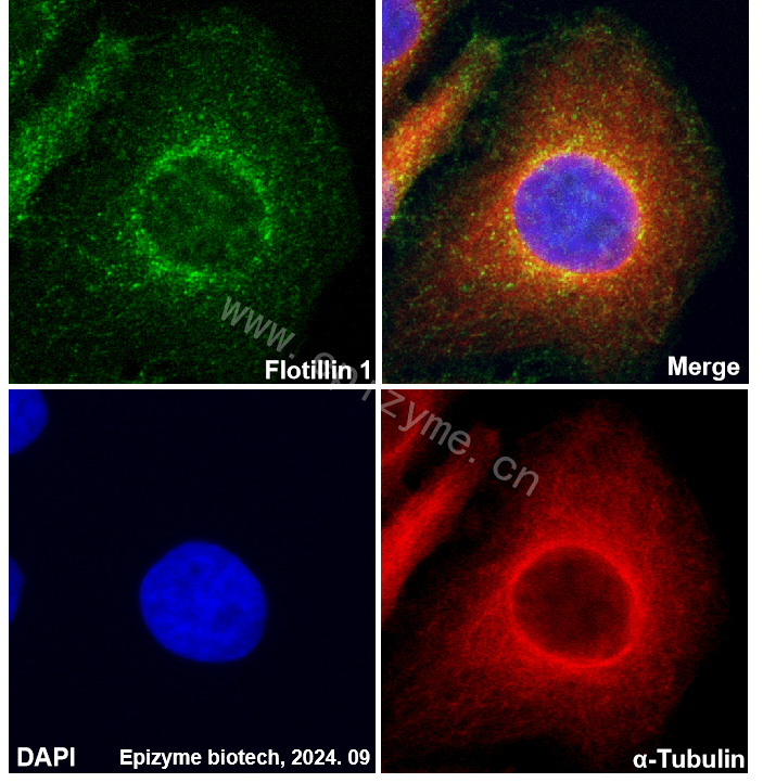 Anti-Flotillin 1 Rabbit mAb [39M15E57]