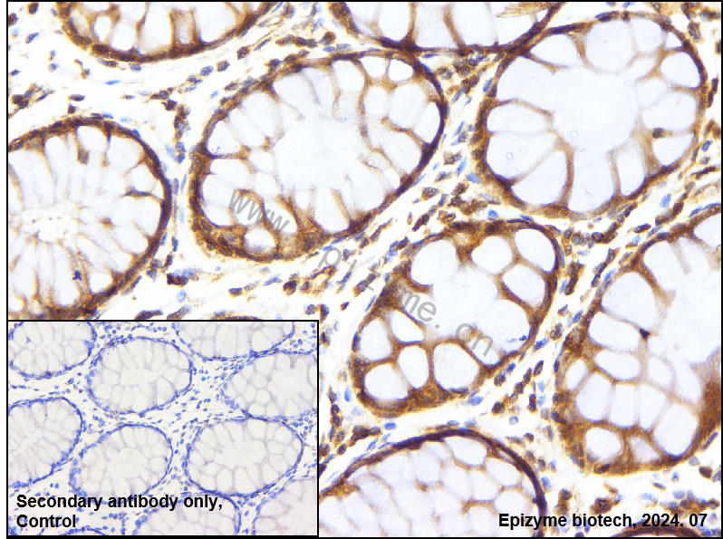 Anti-MEK1 Rabbit mAb [30C09G39]