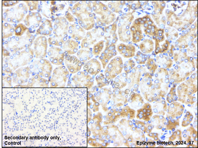 Anti-MEK1 Rabbit mAb [30C09G39]