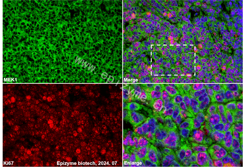 Anti-MEK1 Rabbit mAb [30C09G39]