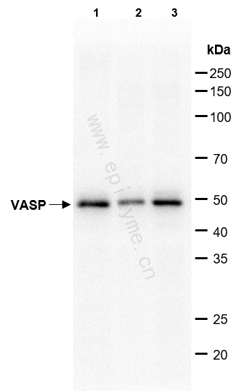 Anti-VASP Rabbit mAb [29K31M05]