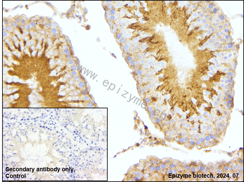 Anti-VASP Rabbit mAb [29K31M05]