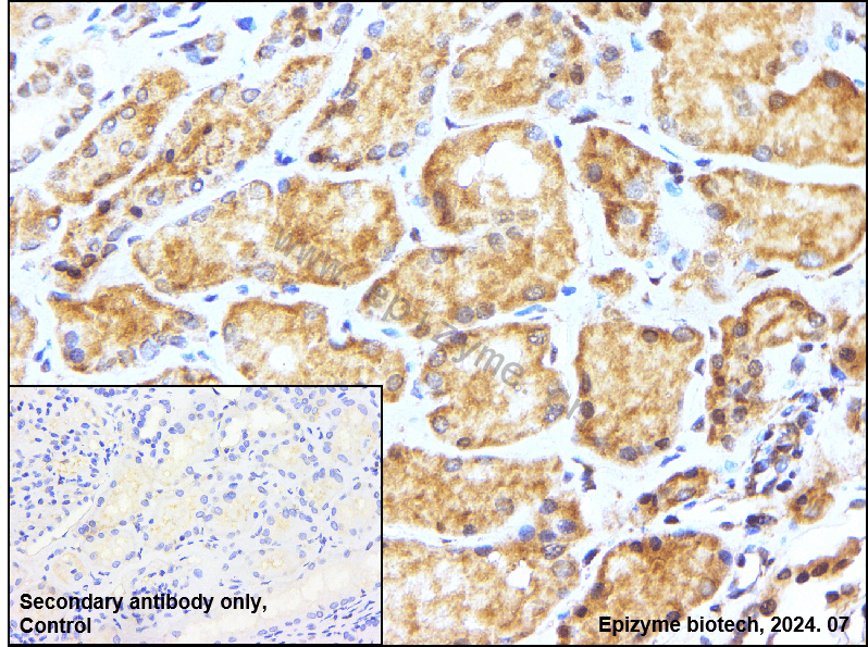 Anti-VASP Rabbit mAb [29K31M05]