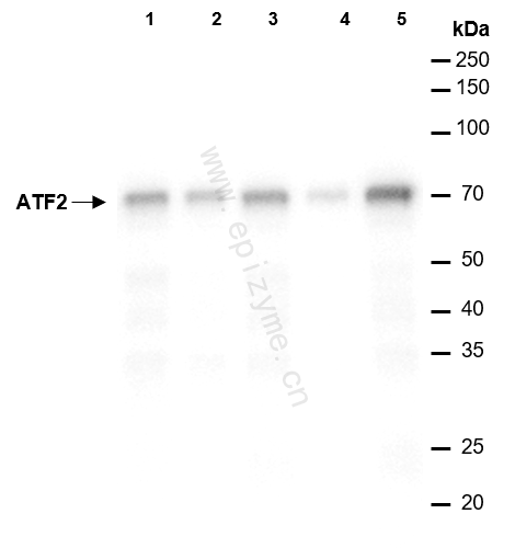 Anti-ATF2 Rabbit mAb [28H92M72]