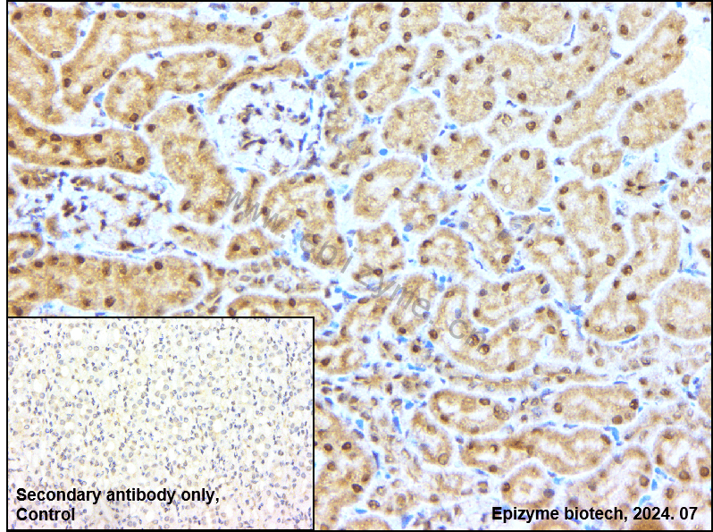 Anti-ATF2 Rabbit mAb [28H92M72]
