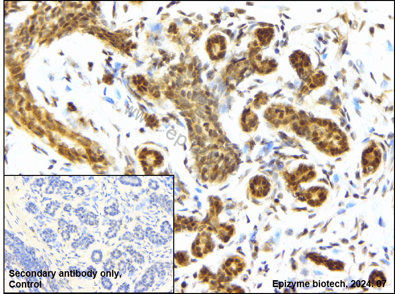 Anti-ATF2 Rabbit mAb [28H92M72]
