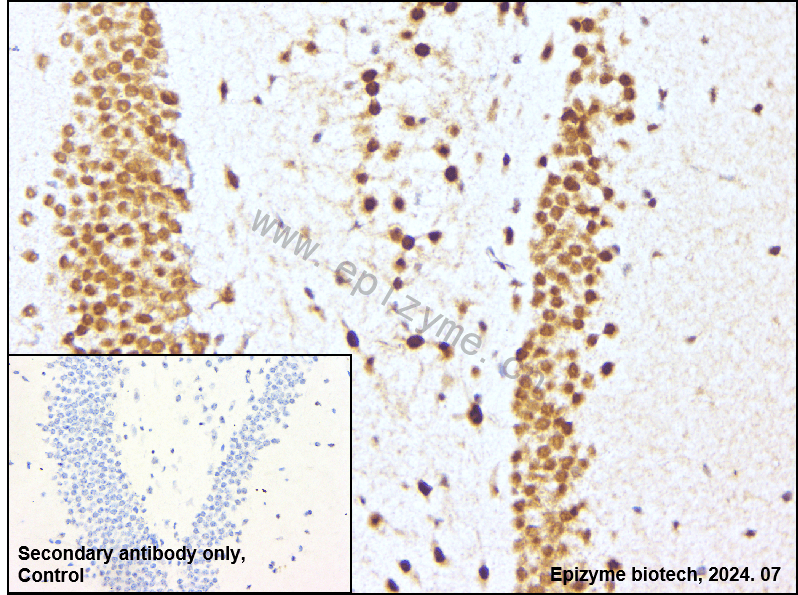 Anti-ATF2 Rabbit mAb [28H92M72]