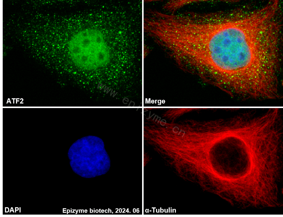 Anti-ATF2 Rabbit mAb [28H92M72]