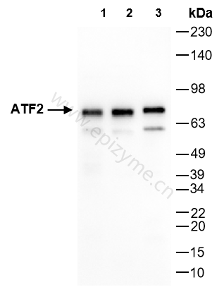 Anti-ATF2 Rabbit mAb [28H92M72]