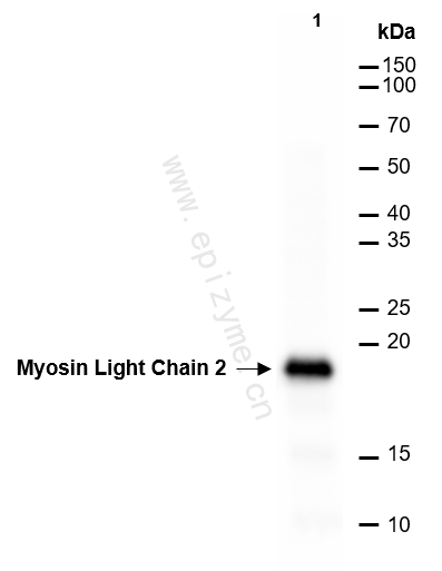 Anti-Myosin Light Chain 2 Rabbit mAb [30B12M39]