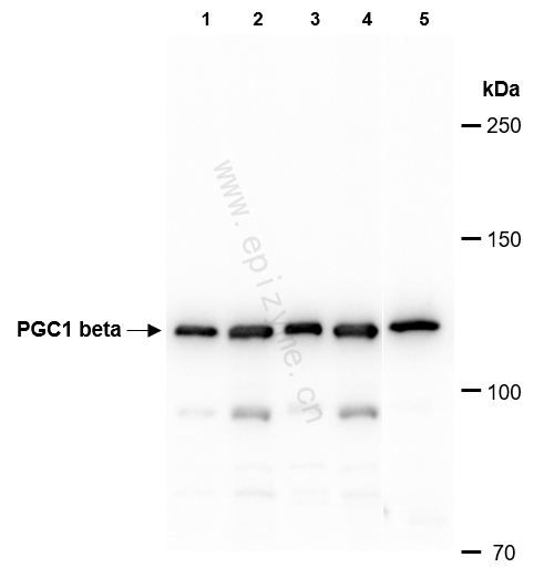 Anti-PGC1 beta Rabbit mAb [83C91M39]