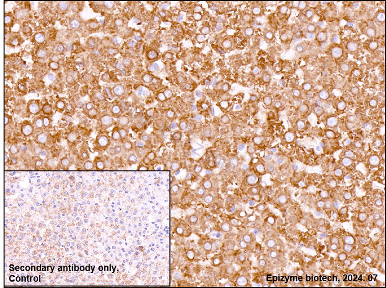 Anti-Fatty Acid Synthase Rabbit mAb [61B05N91]