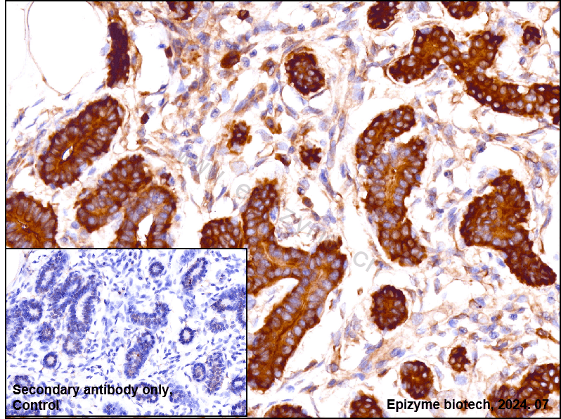 Anti-Fatty Acid Synthase Rabbit mAb [61B05N91]