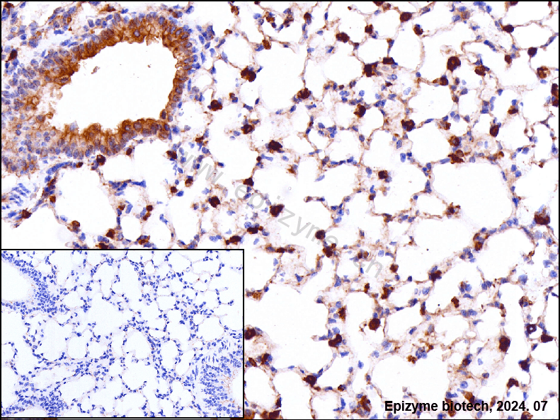 Anti-Fatty Acid Synthase Rabbit mAb [61B05N91]