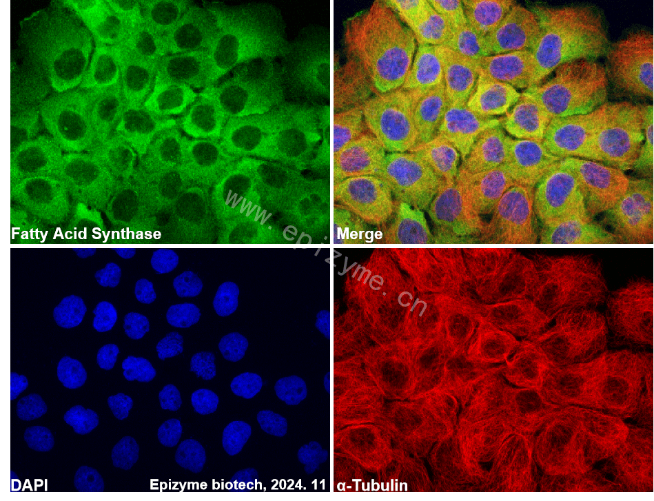 Anti-Fatty Acid Synthase Rabbit mAb [61B05N91]