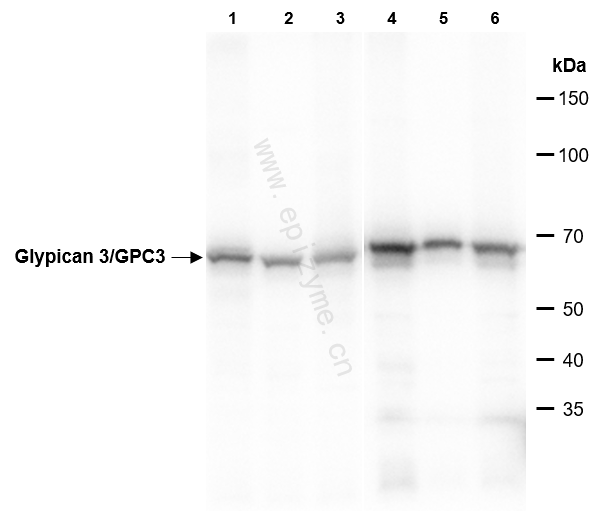 Anti-Glypican 3/GPC3 Rabbit mAb [49A17R21]