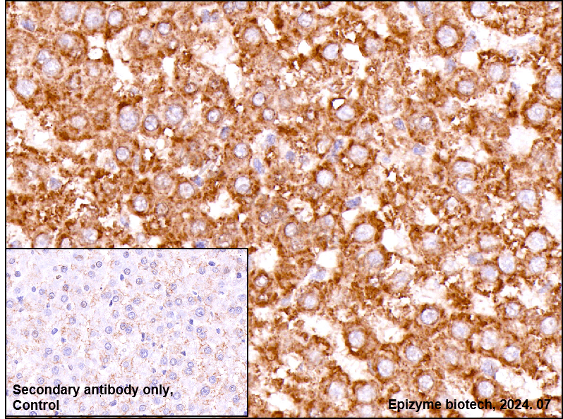 Anti-Glypican 3/GPC3 Rabbit mAb [49A17R21]