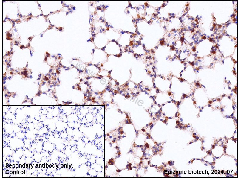 Anti-Glypican 3/GPC3 Rabbit mAb [49A17R21]