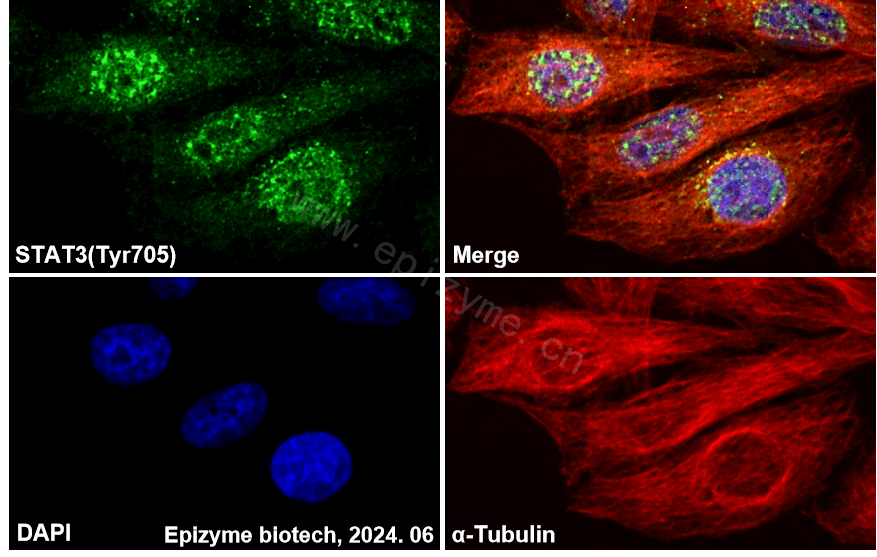 Anti-Phospho-STAT3 (Tyr705) Rabbit mAb [80M35B11]