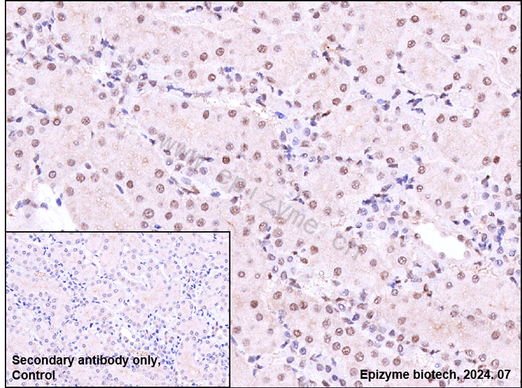 Anti-Phospho-STAT3 (Tyr705) Rabbit mAb [80M35B11]