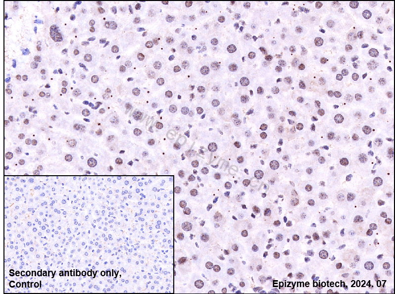 Anti-Phospho-STAT3 (Tyr705) Rabbit mAb [80M35B11]