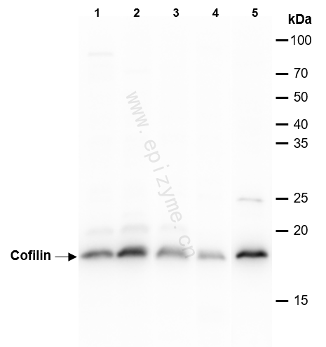 Anti-Cofilin Rabbit mAb [62E49I32]