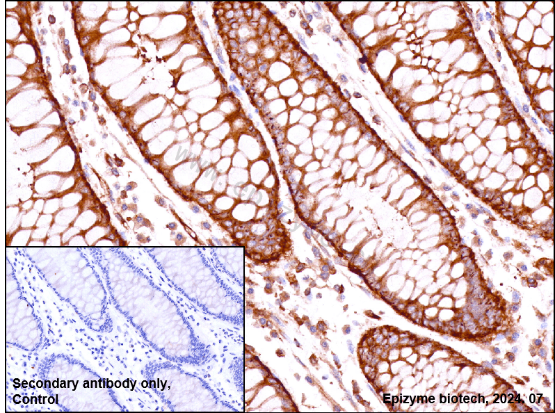 Anti-Cofilin Rabbit mAb [62E49I32]