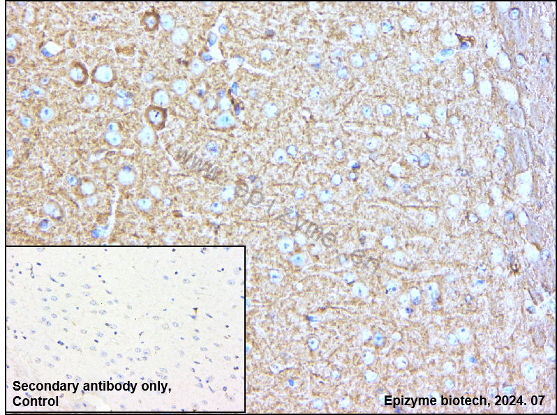 Anti-Amyloid Precursor Protein Rabbit mAb [90M18E62]