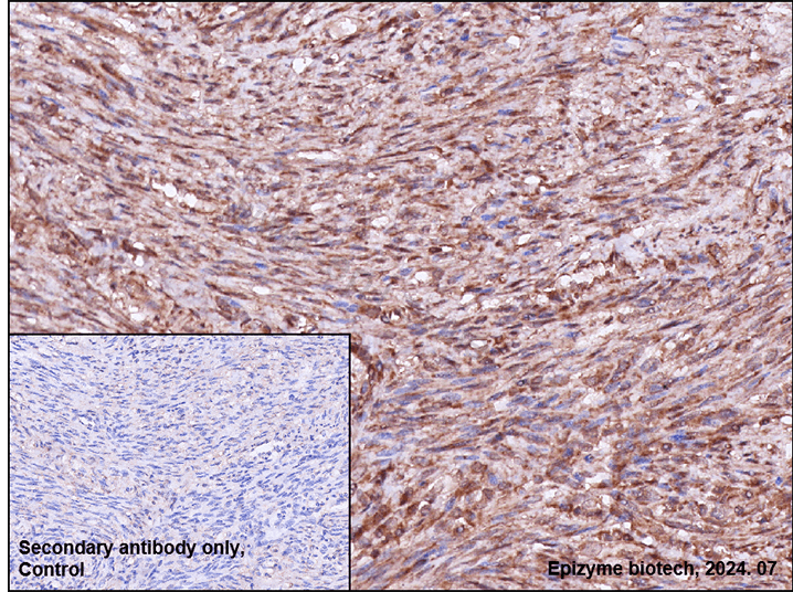 Anti-HSPA4 Rabbit mAb [27E01L62]