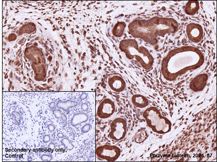 Anti-HSPA4 Rabbit mAb [27E01L62]