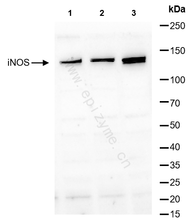 Anti-iNOS Rabbit mAb [29V01R82]