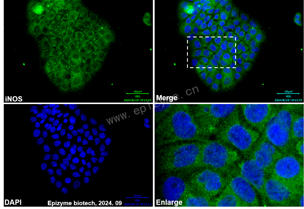 Anti-iNOS Rabbit mAb [29V01R82]