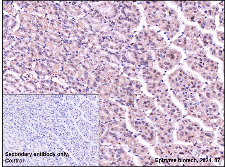 Anti-Phospho-c-Jun (Ser63) Rabbit mAb [32G94E13]
