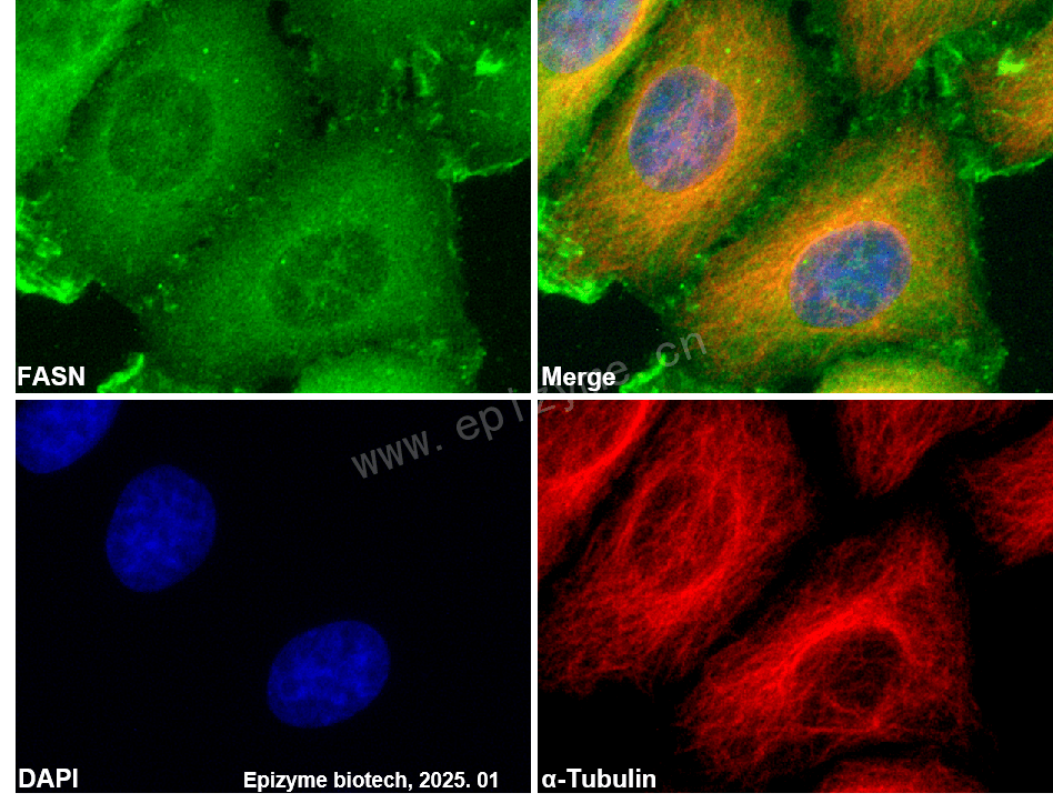 Anti-Fatty Acid Synthase Rabbit mAb [12P06M33]