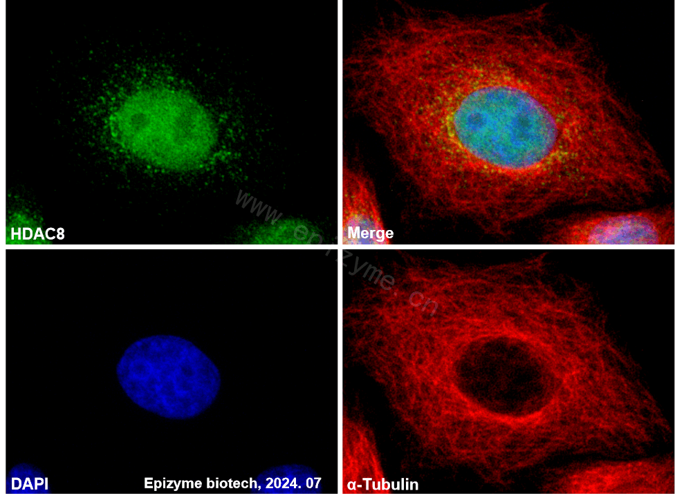 Anti-HDAC8 Rabbit mAb [91G01B73]