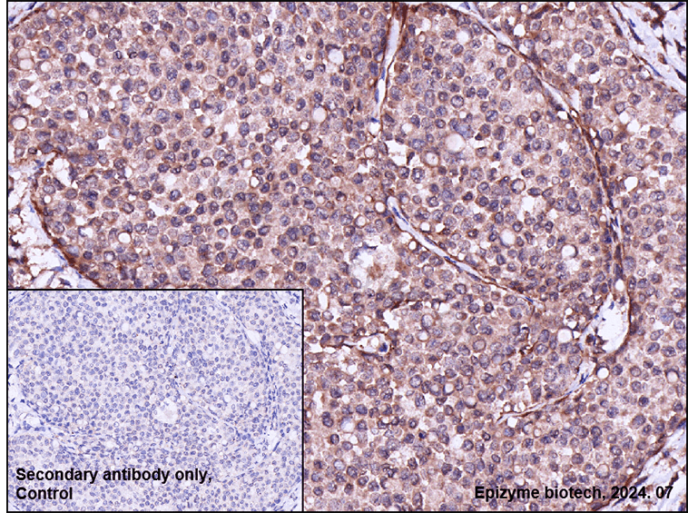 Anti-HDAC8 Rabbit mAb [91G01B73]