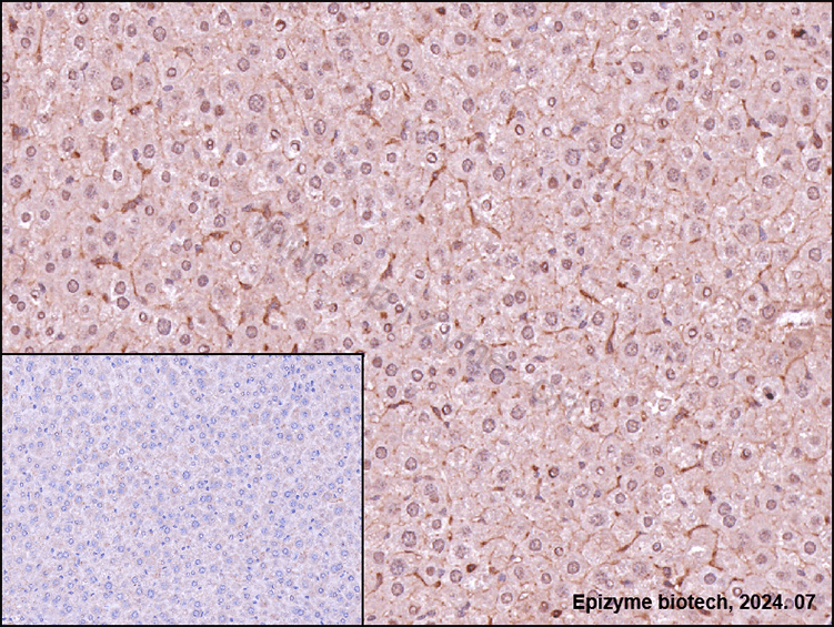 Anti-HDAC8 Rabbit mAb [91G01B73]