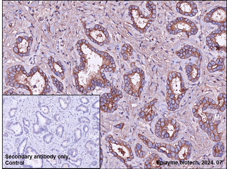 Anti-JNK3 Rabbit mAb [49H40K11]