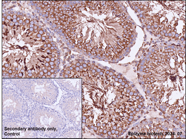 Anti-JNK3 Rabbit mAb [49H40K11]