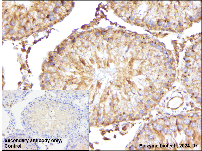 Anti-HE4 Rabbit mAb [78C12E97]