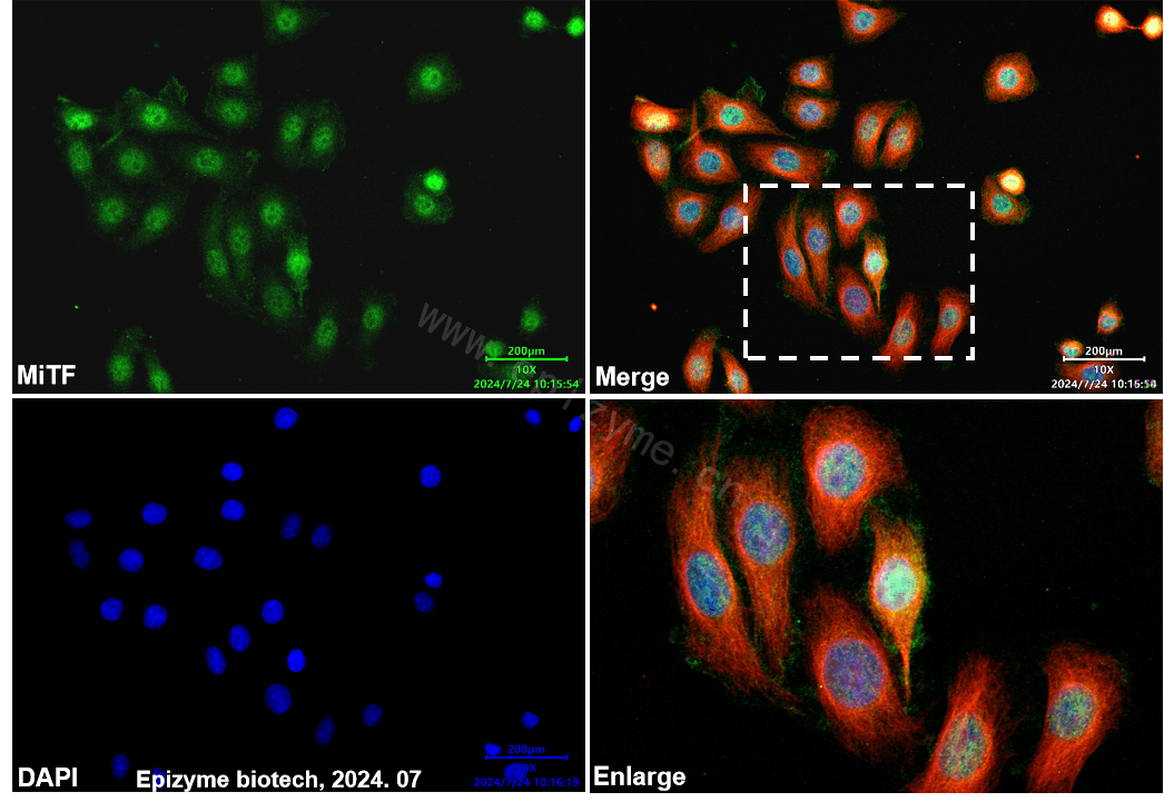 Anti-MiTF Rabbit mAb [48G04M77]