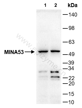 Anti-MINA53 Rabbit mAb [39B21L05]
