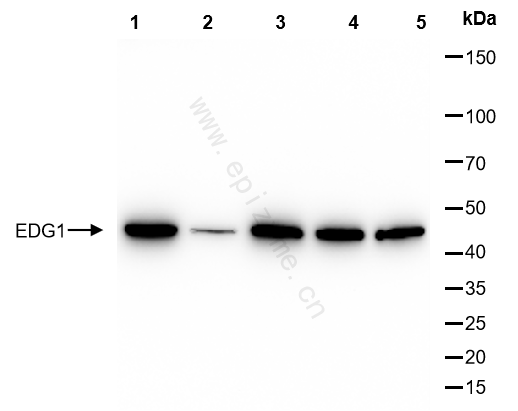 Anti-EDG1 Rabbit mAb [76F99R52]