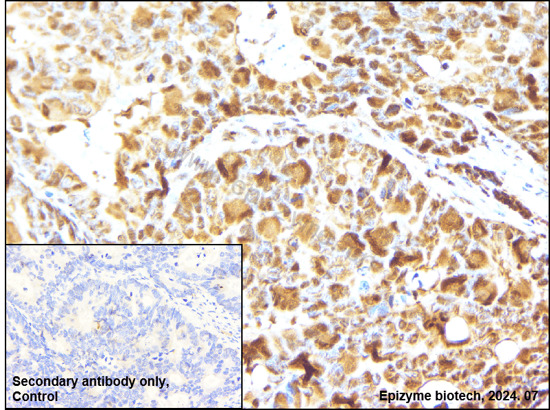 Anti-EDG1 Rabbit mAb [76F99R52]